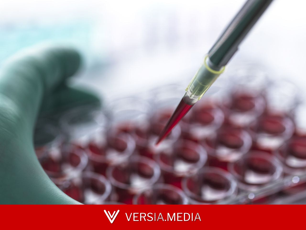 اختراق علمي يغير فهمنا للجهاز المناعي.. آلية مشتركة تجمع بين السرطان وأمراض المناعة الذاتية!